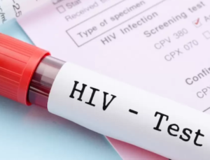 “Kök hücre naklinden sonra düzgünleşmiş 6 HIV hadisesi var”