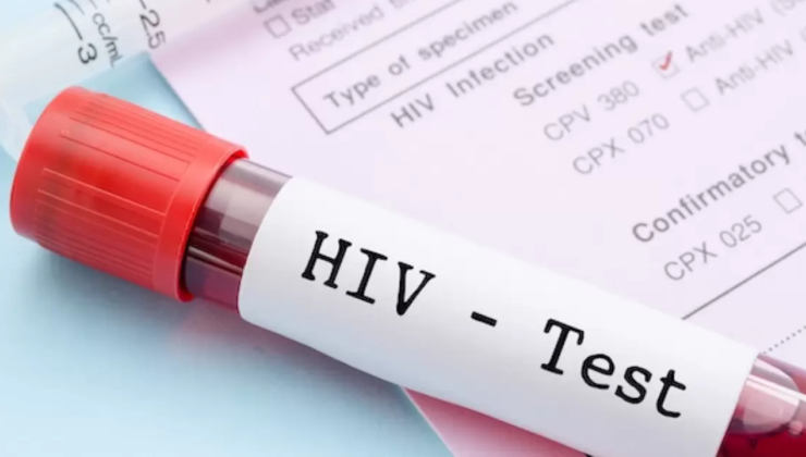 “Kök hücre naklinden sonra düzgünleşmiş 6 HIV hadisesi var”
