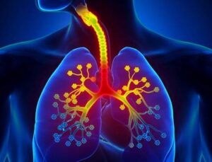 Prof. Dr. Özlü’den “akut bronşit” uyarısı