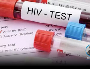 HIV olayları artıyor; “Türkiye tespit etabında bile tıkanıyor, beşerler HIV olumlu olduğunu tesadüfen öğreniyor”
