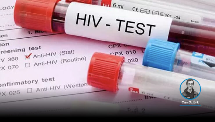 HIV olayları artıyor; “Türkiye tespit etabında bile tıkanıyor, beşerler HIV olumlu olduğunu tesadüfen öğreniyor”