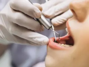 Diş sıhhatinde randevu krizi: Talep arttı, kapasite yetersiz kaldı